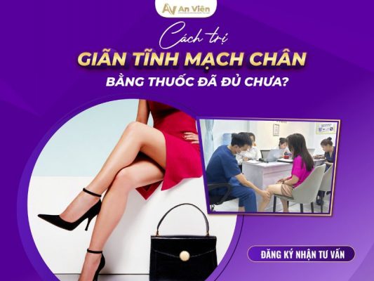 cách trị suy giãn tĩnh mạch ở chân