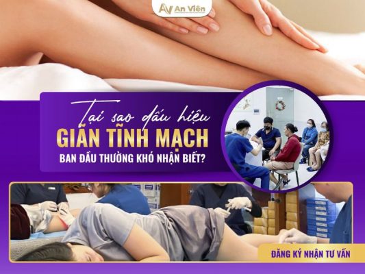 dấu hiệu chân bị giãn tĩnh mạch