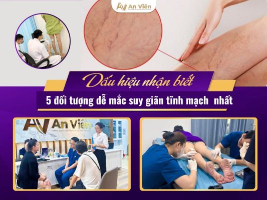 dấu hiệu suy giãn tĩnh mạch chi dưới