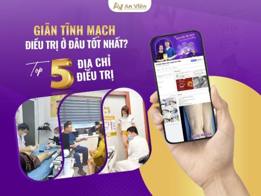 giãn tĩnh mạch chân điều trị
