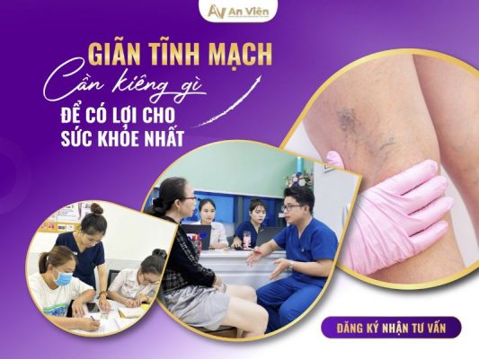 giãn tĩnh mạch chân kiêng gì