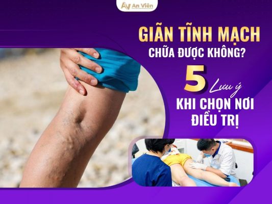 giãn tĩnh mạch chữa được không