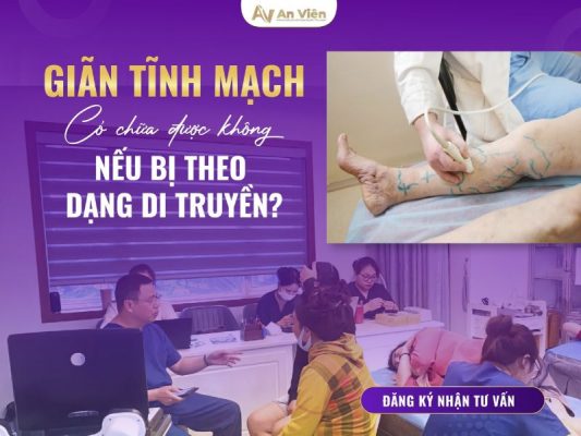 giãn tĩnh mạch có chữa được không