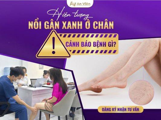 hiện tượng nổi gân xanh ở chân