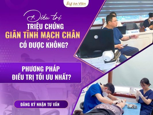 triệu chứng bị giãn tĩnh mạch chân
