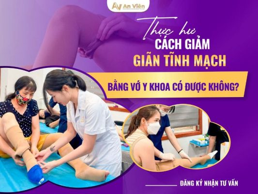 cách làm giảm giãn tĩnh mạch