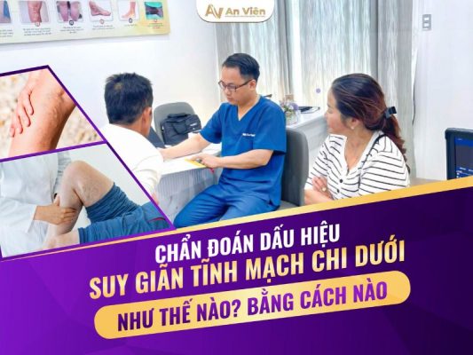 dấu hiệu bệnh giãn tĩnh mạch chi dưới