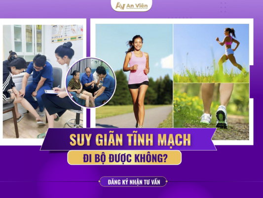 suy giãn tĩnh mạch có đi bộ được không