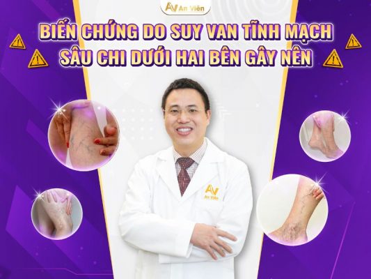 suy van tĩnh mạch sâu chi dưới hai bên