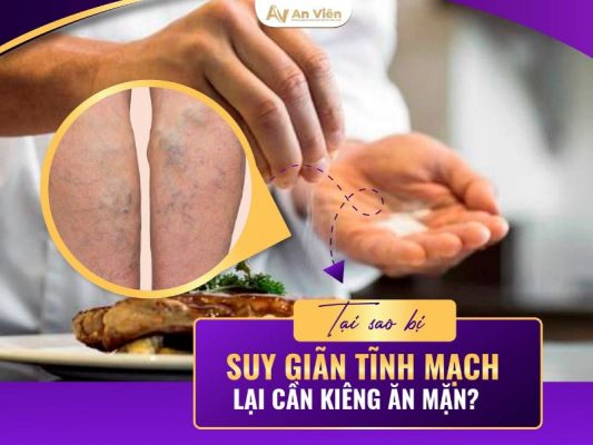 tại sao giãn tĩnh mạch
