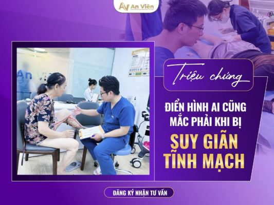 triệu chứng của giãn tĩnh mạch