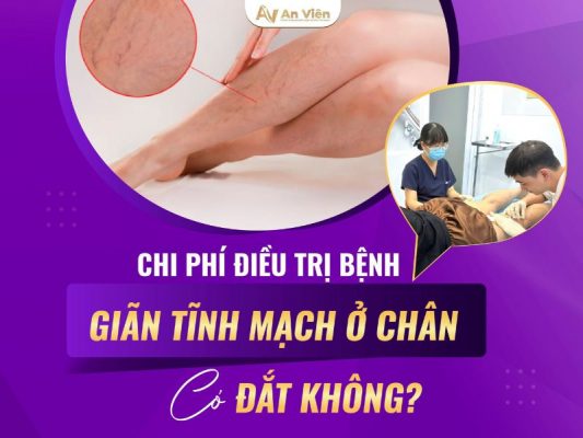 bệnh suy tĩnh mạch ở chân