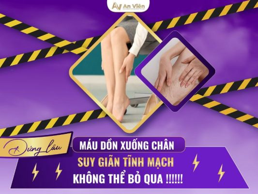đứng lâu máu dồn xuống chân