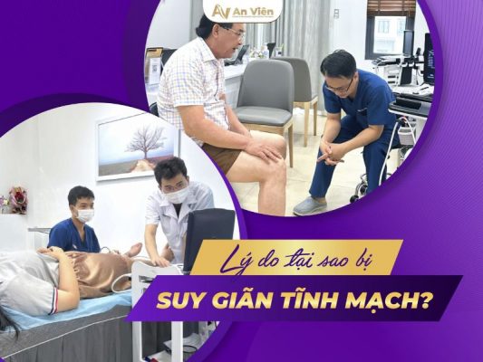 lý do bị giãn tĩnh mạch chân