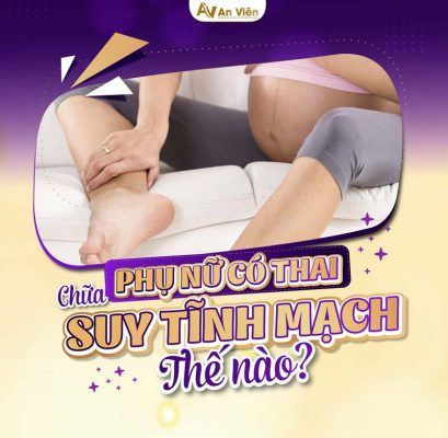 mạch máu nổi gân xanh