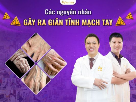 nguyên nhân giãn tĩnh mạch tay