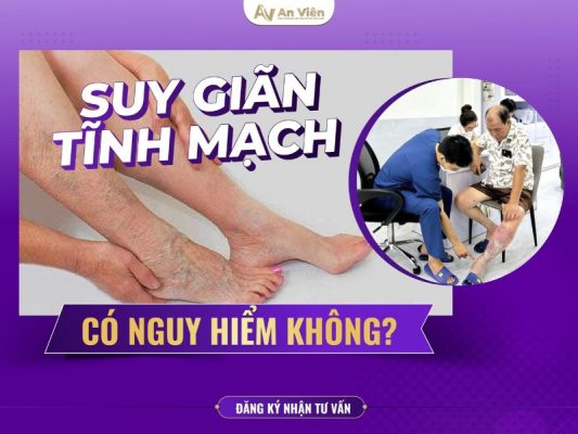 suy tĩnh mạch có nguy hiểm không