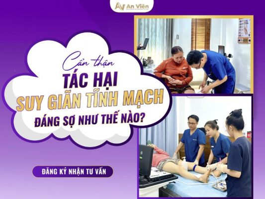 tác hại của giãn tĩnh mạch