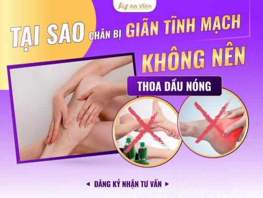 tại sao chân bị giãn tĩnh mạch