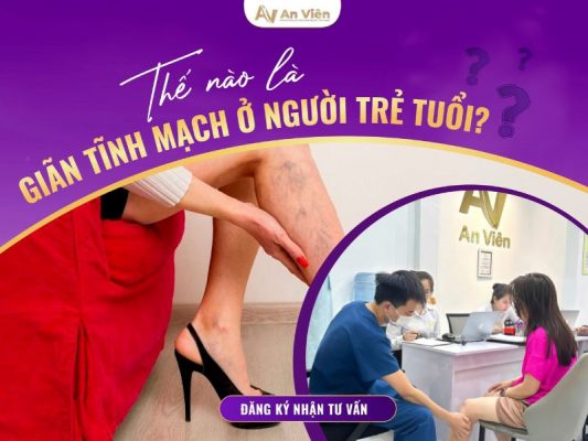 thế nào là giãn tĩnh mạch
