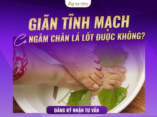 giãn tĩnh mạch có ngâm lá lốt được không