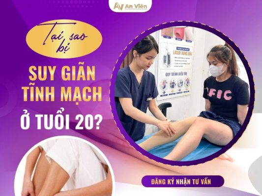 lý do bị giãn tĩnh mạch chân