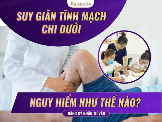 suy giãn tĩnh mạch chi dưới có nguy hiểm không