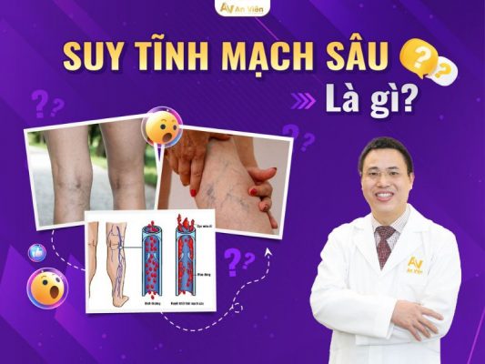suy tĩnh mạch sâu là gì