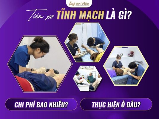 tiêm xơ tĩnh mạch là gì