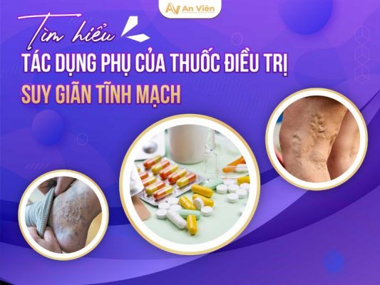 triệu chứng suy giảm tĩnh mạch