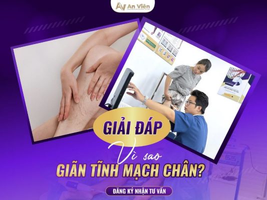 vì sao bị giãn tĩnh mạch chân