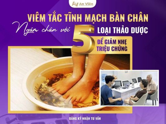 viêm tắc tĩnh mạch bàn chân