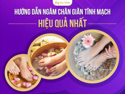 bàn chân bị giãn tĩnh mạch