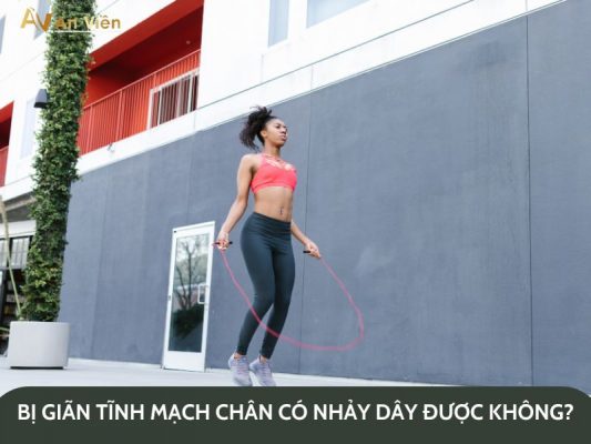 bị giãn tĩnh mạch chân có nhảy dây được không