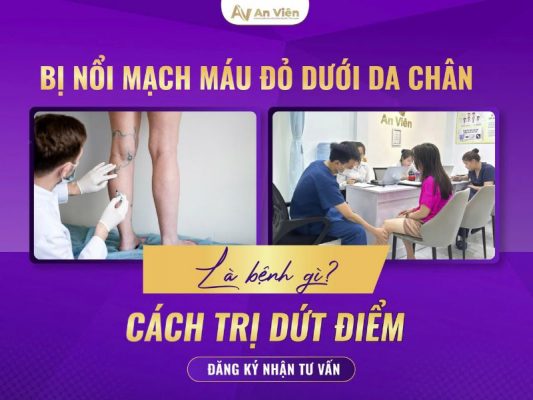 bị nổi mạch máu đỏ dưới da chân