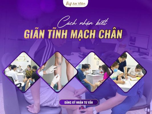 cách nhận biết giãn tĩnh mạch chân