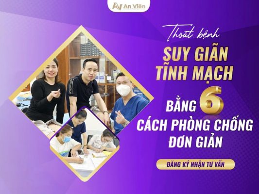 cách phòng chống suy giãn tĩnh mạch