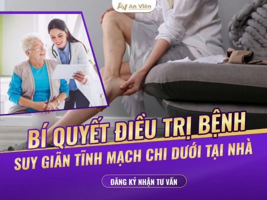 dấu hiệu bệnh suy giãn tĩnh mạch chi dưới