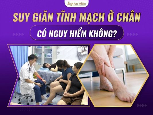 giãn tĩnh mạch ở chân có nguy hiểm không