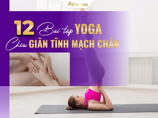 bài tập yoga chữa giãn tĩnh mạch chân