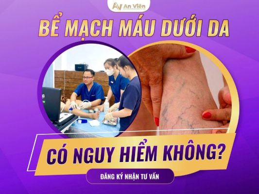 bể mạch máu ở chân
