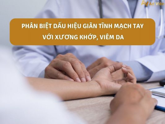 dấu hiệu giãn tĩnh mạch tay