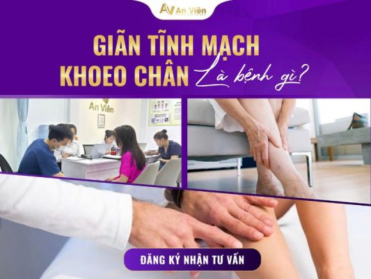giãn tĩnh mạch khoeo chân
