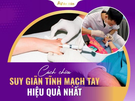 Triệu chứng suy giãn tĩnh mạch,Cách trị suy giãn tĩnh mạch chân tại nhà, Thuốc điều trị suy giãn tĩnh mạch chi dưới,Bài tập thể dục dành cho người giãn tĩnh mạch chân