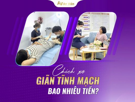 chích xơ suy giãn tĩnh mạch bao nhiêu tiền