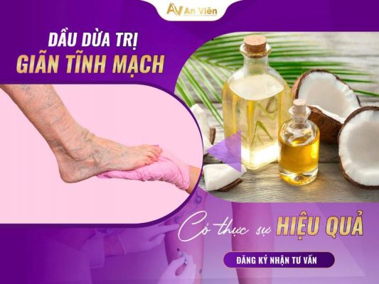 dầu dừa trị giãn tĩnh mạch