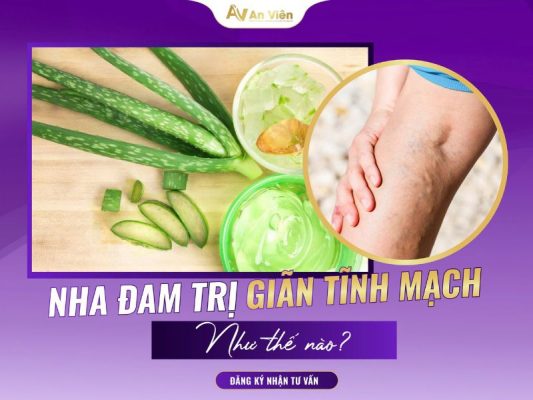 nha đam trị giãn tĩnh mạch
