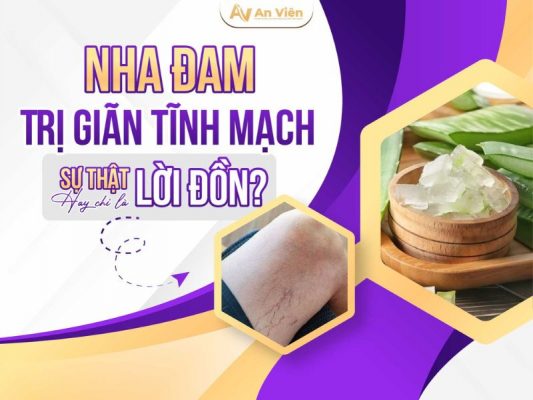 nha đam trị giãn tĩnh mạch