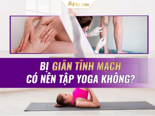 yoga giãn tĩnh mạch