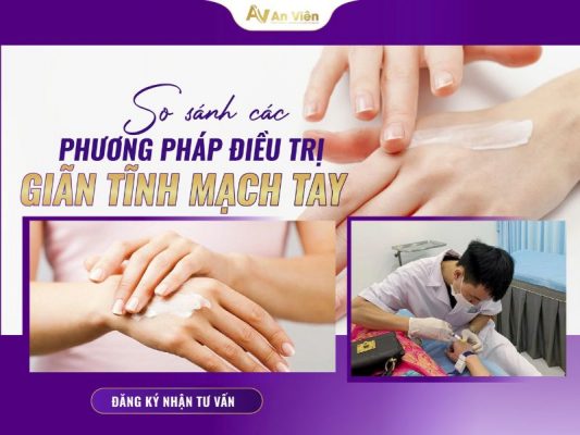 suy tĩnh mạch tay